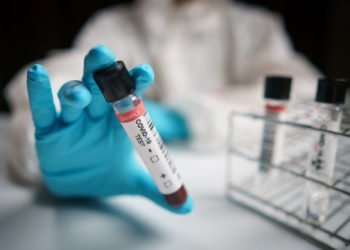 कोरोनावायरस से मुकाबले के लिए केंद्रीय औषधि अनुसंधान संस्थान के प्रयास