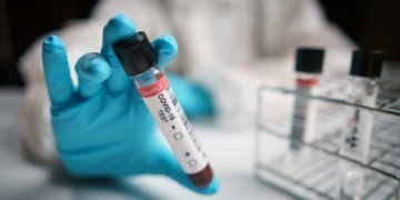 कोरोनावायरस से मुकाबले के लिए केंद्रीय औषधि अनुसंधान संस्थान के प्रयास