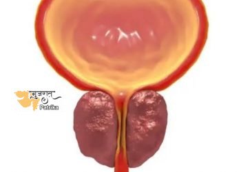प्रोस्टेट कैंसर से पीड़ित पुरुष अगर अनजान हैं तो जानिए क्या है यह कैंसर और क्या हैं इसके लक्षण